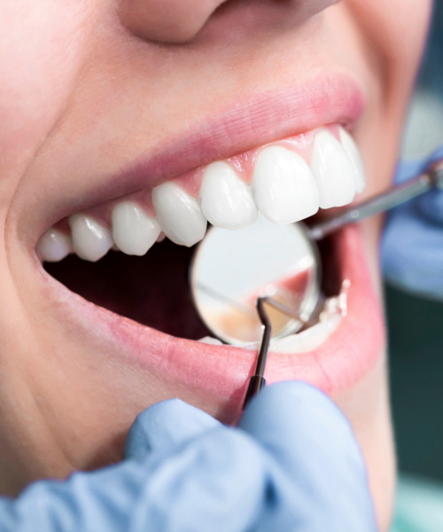 tannlege sandvika storsenter